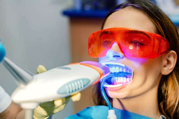 Simplifying Teeth Whitening: A Comprehensive Guide Maidenhead