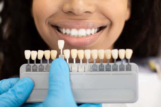 Laser Teeth Whitening: Exploring the Longevity of Your Brighter Smile Maidenhead