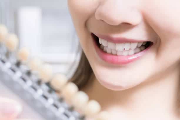 Teeth Whitening Kings Norton Maidenhead