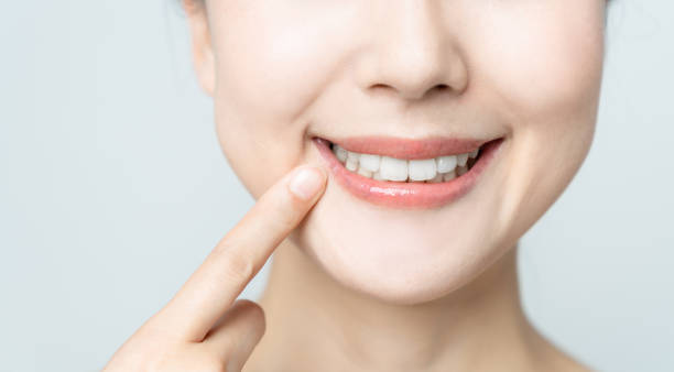 Comparing the Pain Factor: Laser Teeth Whitening vs. Zoom Teeth Whitening Maidenhead