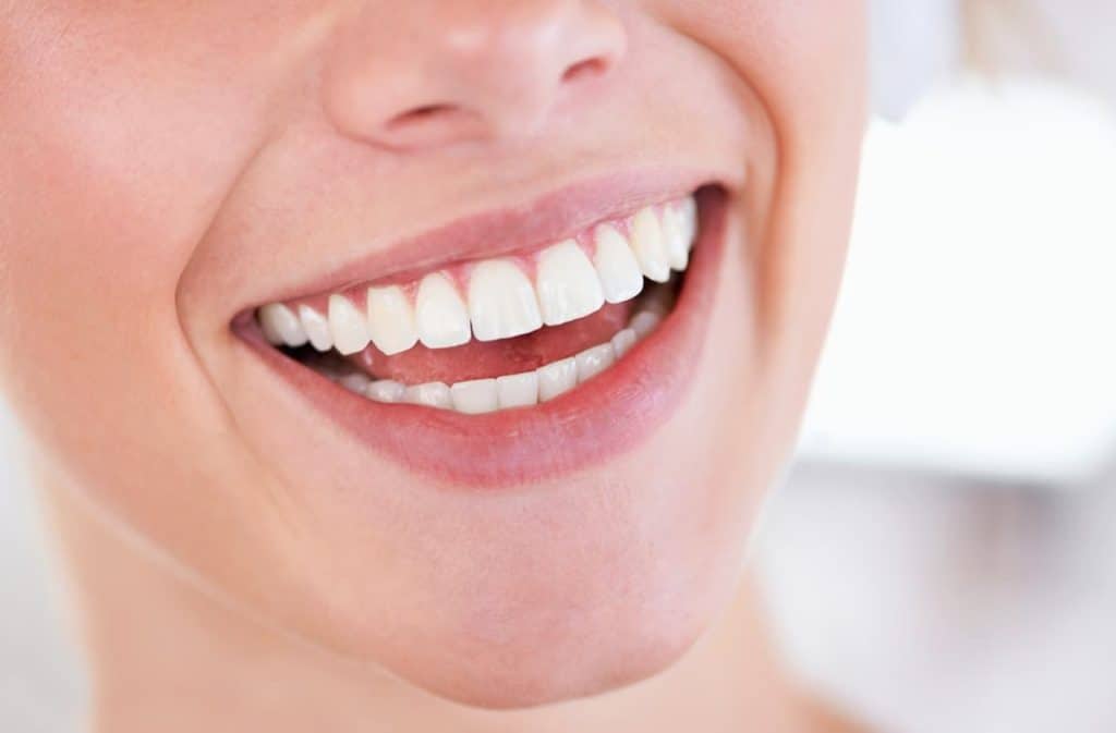 Teeth Whitening West Drayton Maidenhead