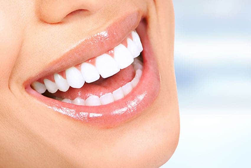 Teeth Whitening Abingdon Maidenhead